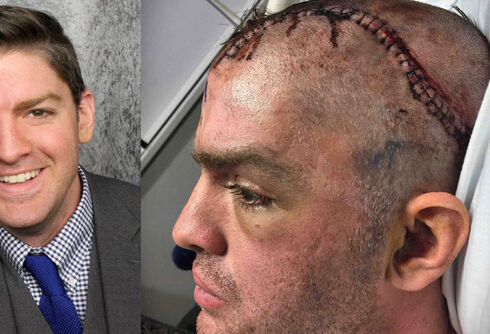 Masked men in Dallas beat gay actor to a pulp with wooden pole