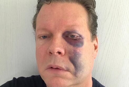 San Diego drag queen club owner beaten while being called anti-gay slur