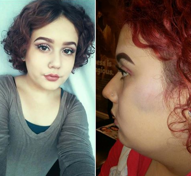 Photo of assaulted transgender teen goes viral as aunt pleads for justice