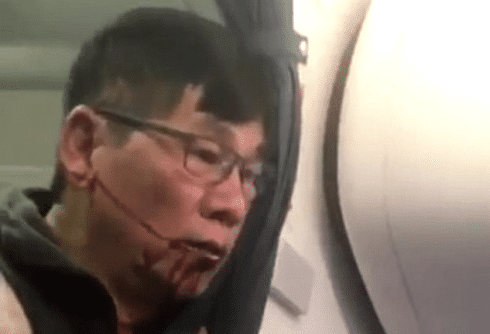 What does the United passenger’s sexuality have to do with his treatment?