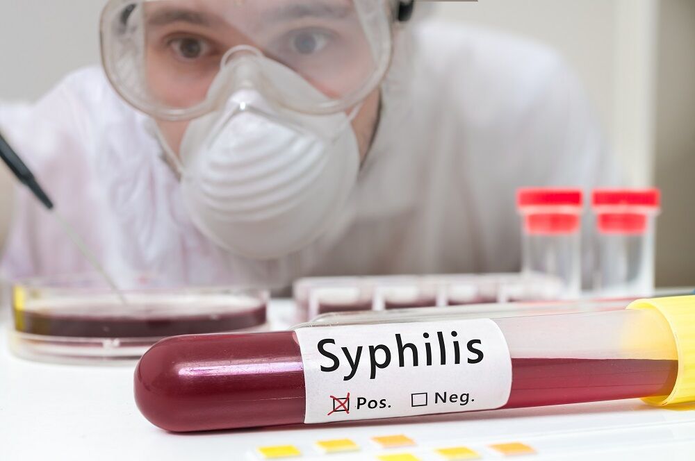 Gay men at risk of syphilis in South, report says