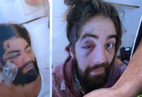 Two arrested in attack that left the victim blind in one eye