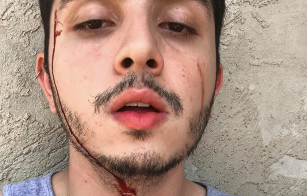 Gay man viciously beaten by his sister & brother-in-law