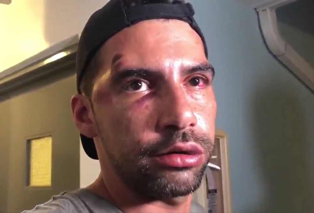 A couple was attacked for holding hands at Miami Pride. How police reacted made it worse.