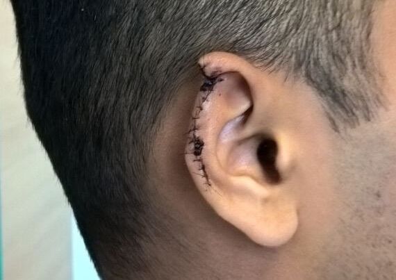 Photo of the victim's damaged ear