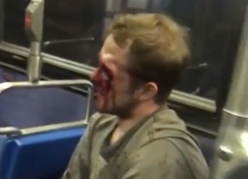 Bloodied would-be gay basher recovering after losing the fight