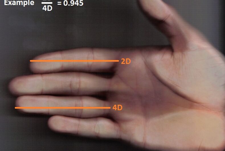 2d-4d-ratio 2d-4d-ratio