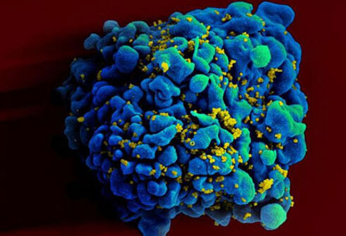 Second person cured of HIV in major medical breakthrough