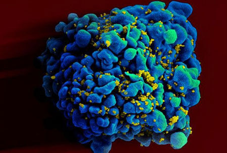 HIV cell under a microscope