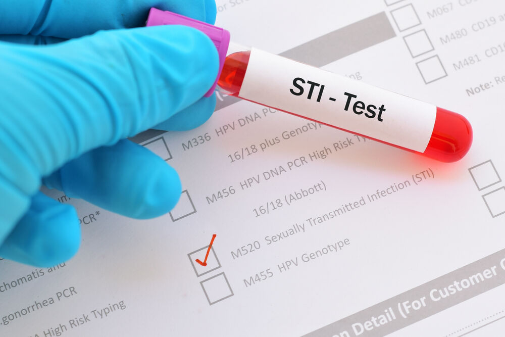 Prep study, condoms, STIs