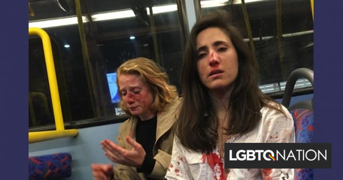 Lesbian Couple Brutally Attacked For Refusing Gang Of