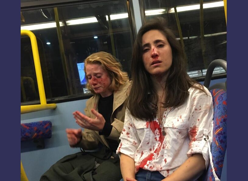 Melania Geymonat and her girlfriend with blood on them
