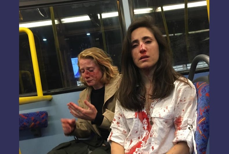 Melania Geymonat, lesbian bashing victim and her girlfriend Chris have blood on their faces and clothes while riding the bus.