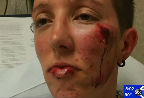 A man viciously beat a lesbian couple while calling one of women ‘a dude’