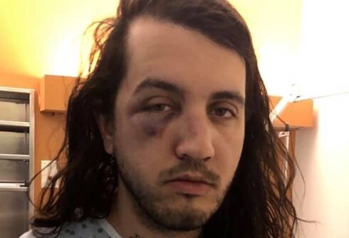 Gaybashing witnesses screamed, ‘Stop, you’re going to kill him!’