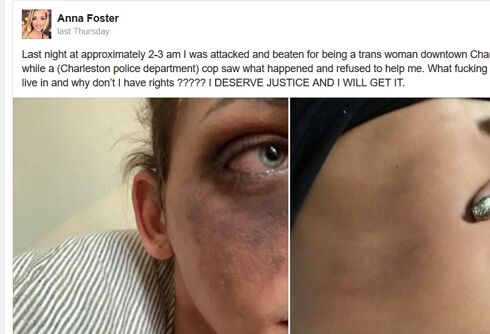 Trans woman says a police officer saw her being severely beaten & did nothing