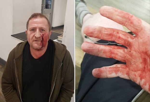 Marc Power was attacked earlier this week by teenage boys with hammers.