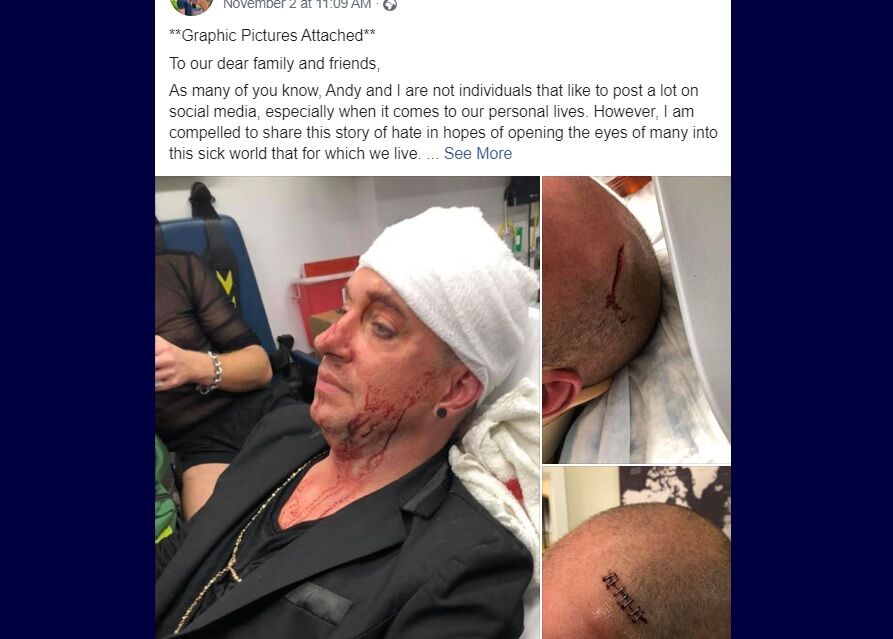 One of the victims posted pictures of another victim's injuries to Facebook.