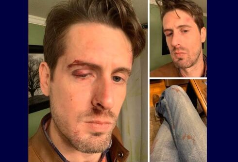 Bartender knocked unconscious & others injured as 2 men attacked a gay bar