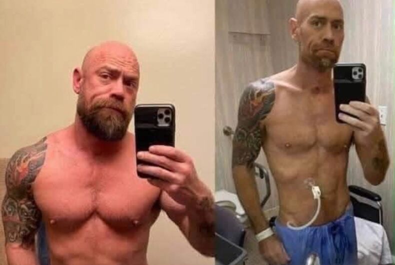 Before-after-Schultz Winter Party attendee who caught coronavirus posts shocking photo of virus’ effect on his body