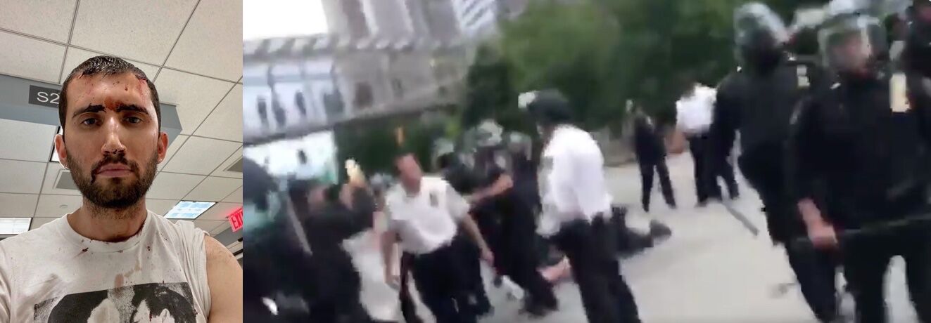 Activist Jason Rosenberg suffered a broken arm and required staples to his head to seal wounds