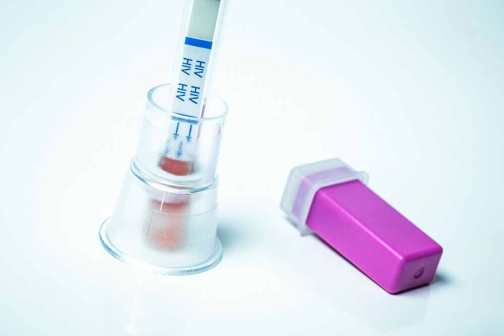 A home HIV test kit