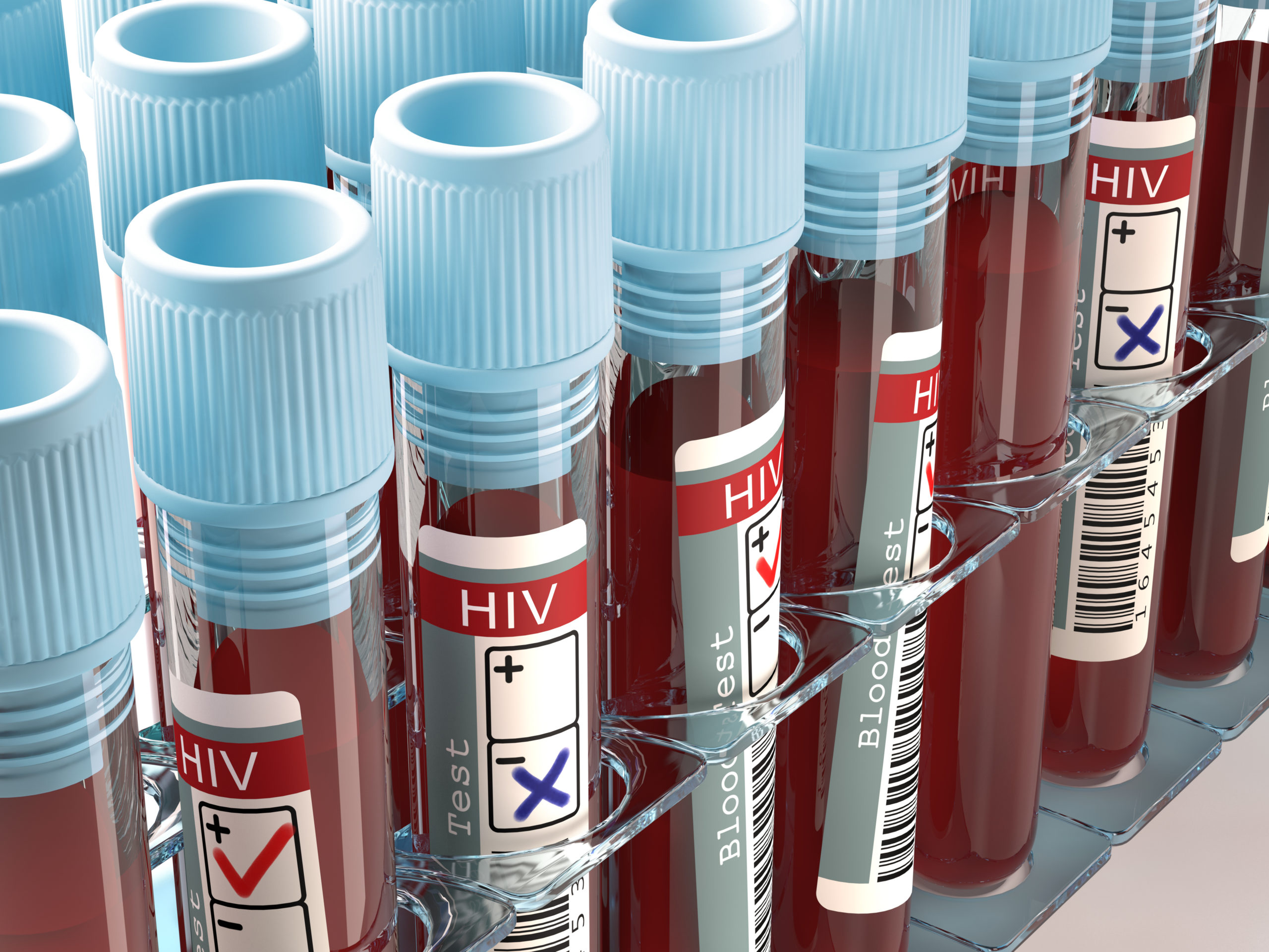 HIV, drug-resistant strain