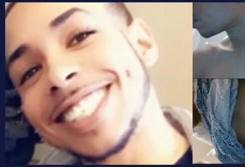 A Black gay man was slashed & left for dead by strangers. He spent the holidays in the hospital.