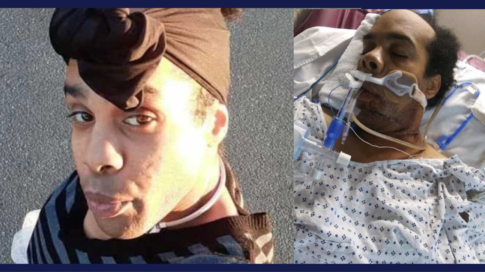 Isaiah L. Brown before (left) and after being shot by a sheriff's deputy