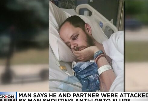 Thug shouting slurs fractures gay man’s skull as his partner screams for help
