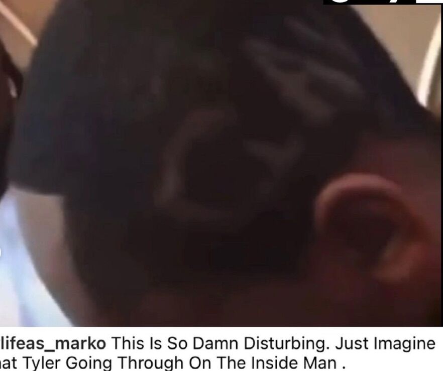 An adult carved "GAY" into Tyler's hair in a clip shared on social media