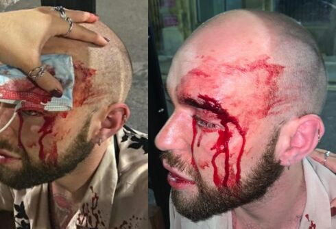 Gay man thought he was going to die in terrifying gang attack