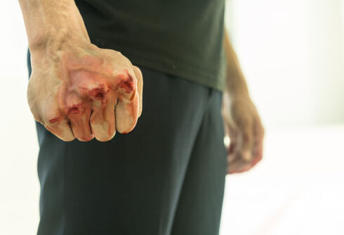 Four attackers break 72-year-old man’s jaw while shouting anti-gay slurs