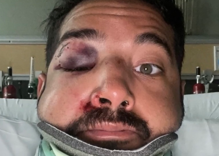 Man gets knocked unconscious & beaten by two complete strangers in park for being gay