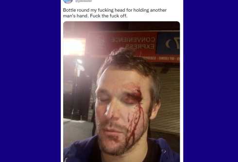 Stranger beat man with a wine bottle for holding hands with another man