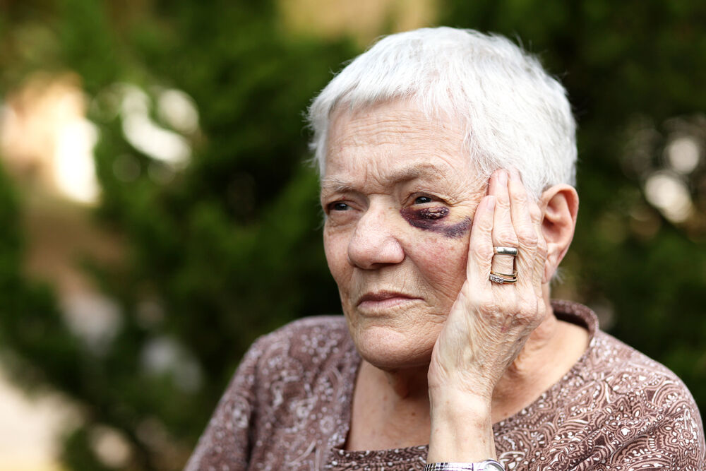 An elderly woman with a black eye