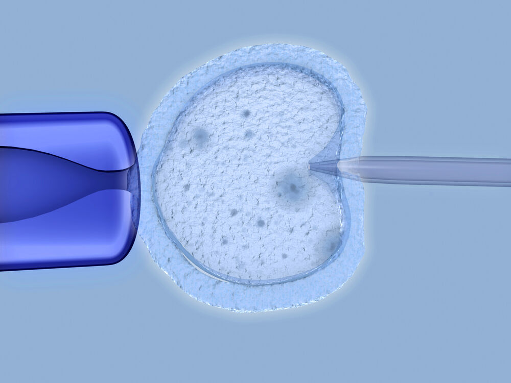 IVF happening in a lab