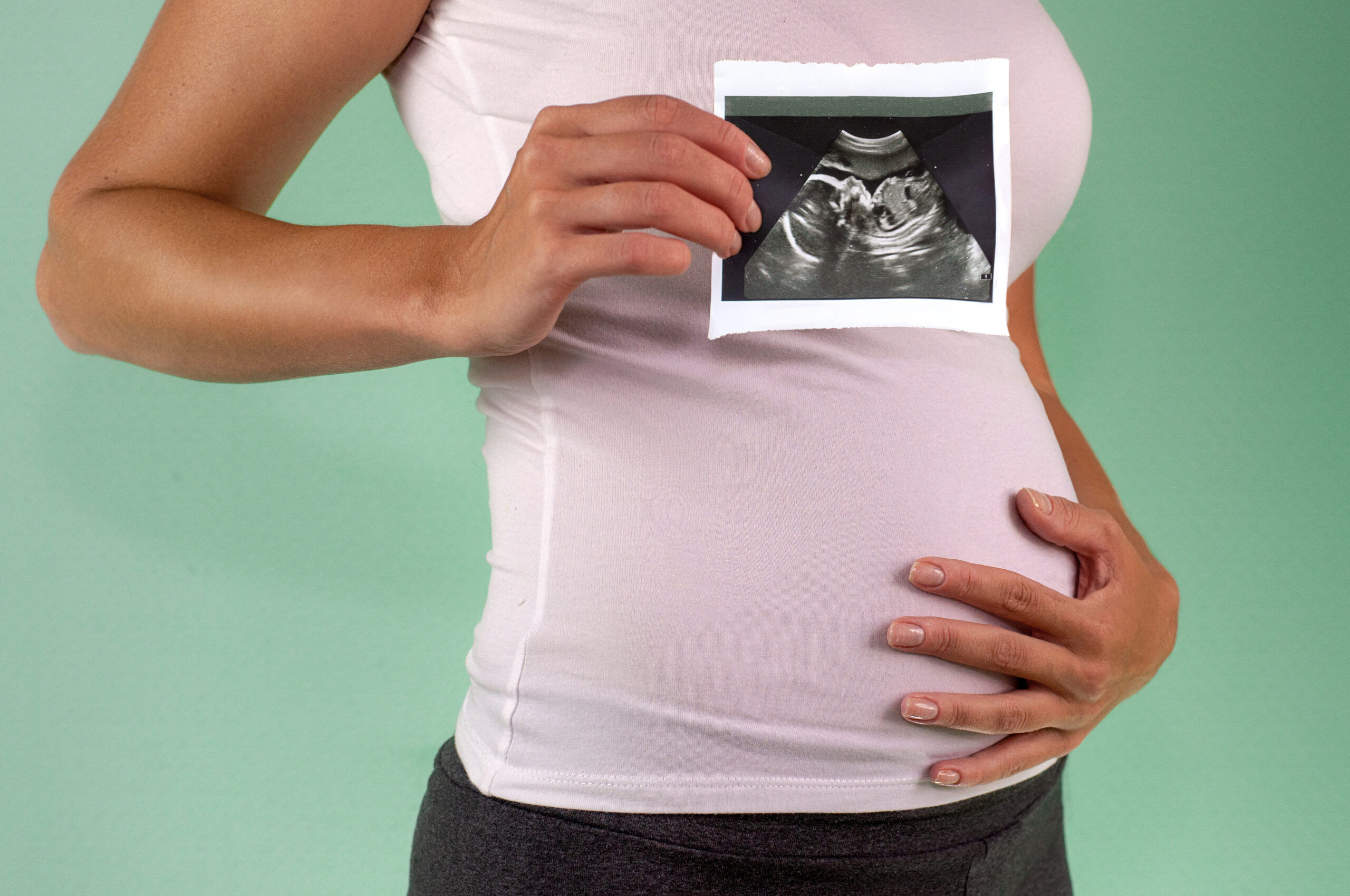 The girl is holding a snapshot of an ultrasound in the fourth week of pregnancy. First trimester. Confirmation of pregnancy