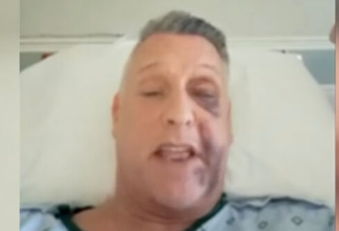 Gay man brutally beaten by attackers shouting anti-LGBTQ+ slur