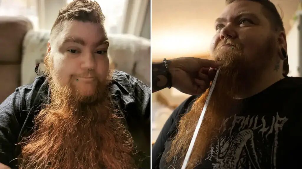 Erin Honeycutt is a Guinness World Record holder for the longest female beard