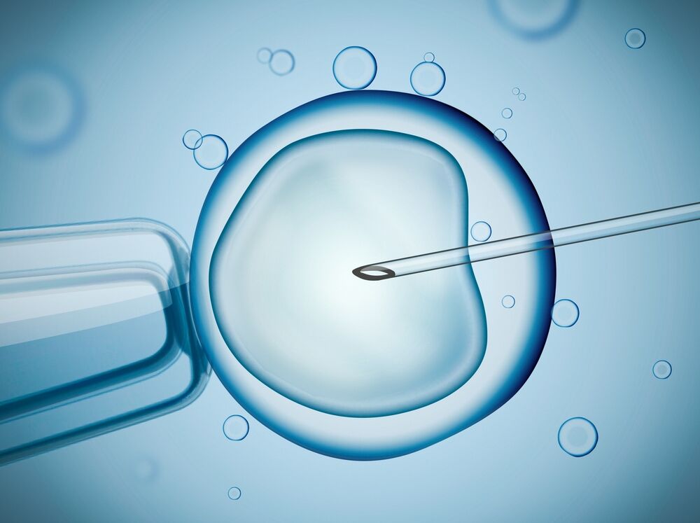 IVF, sperm, egg, fertilization