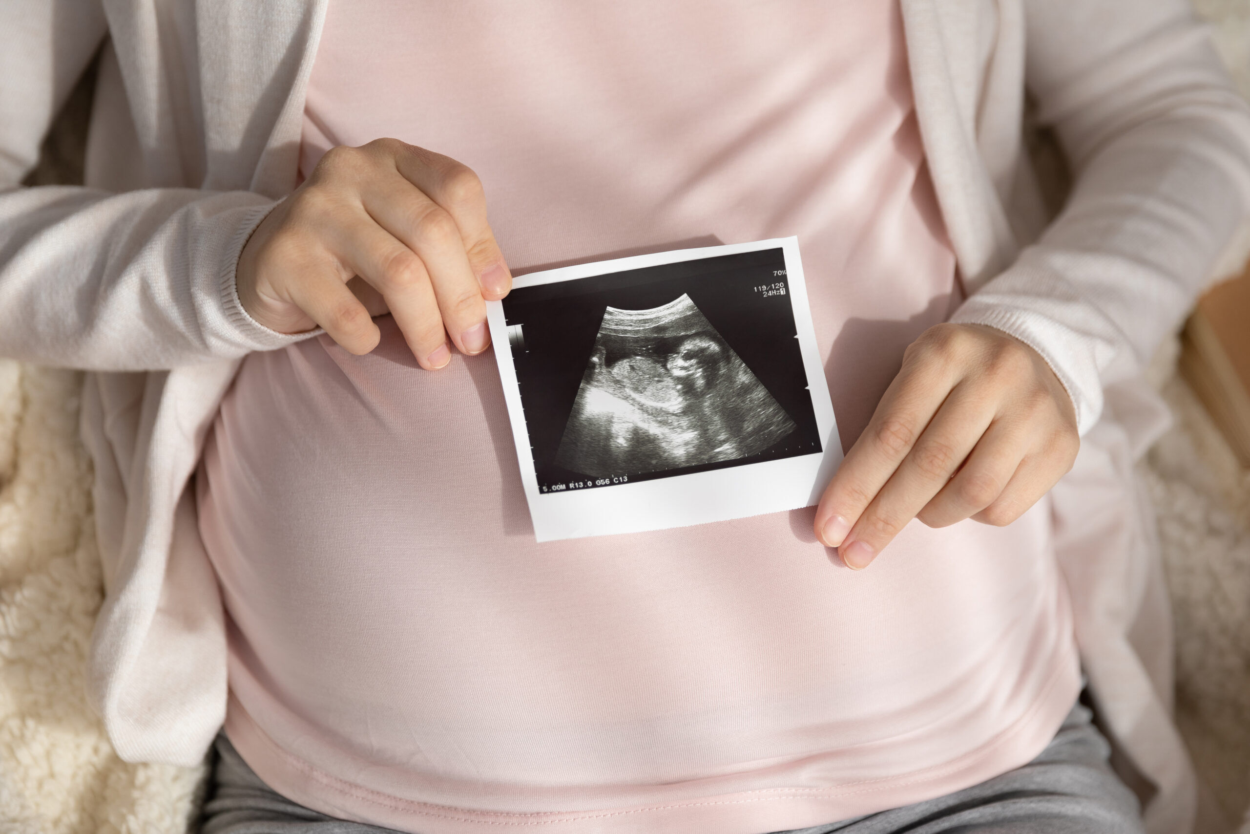 Aetna agrees to provide equal fertility coverage for LGBTQ+ people in landmark settlement
