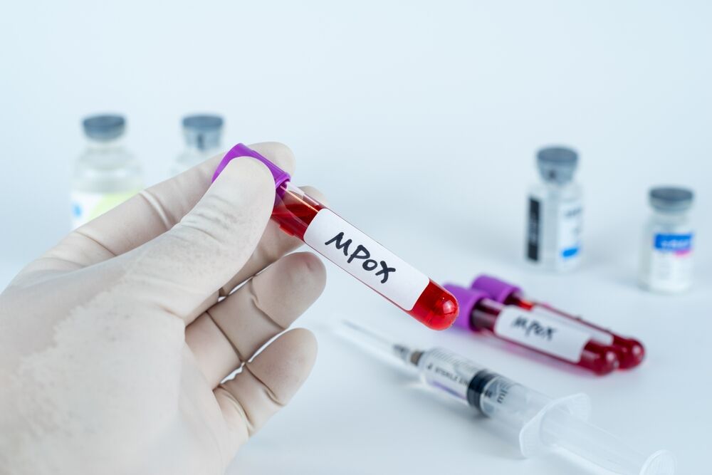CDC is urging LGBTQ+ people to get mpox vaccine during Pride Month