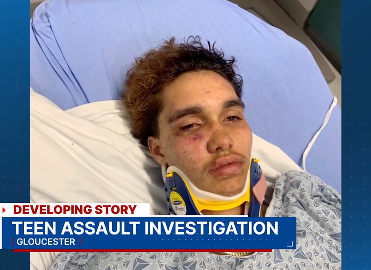 Trans teen brutally beaten by classmates who were later &#8220;proud&#8221; of their violence on social media