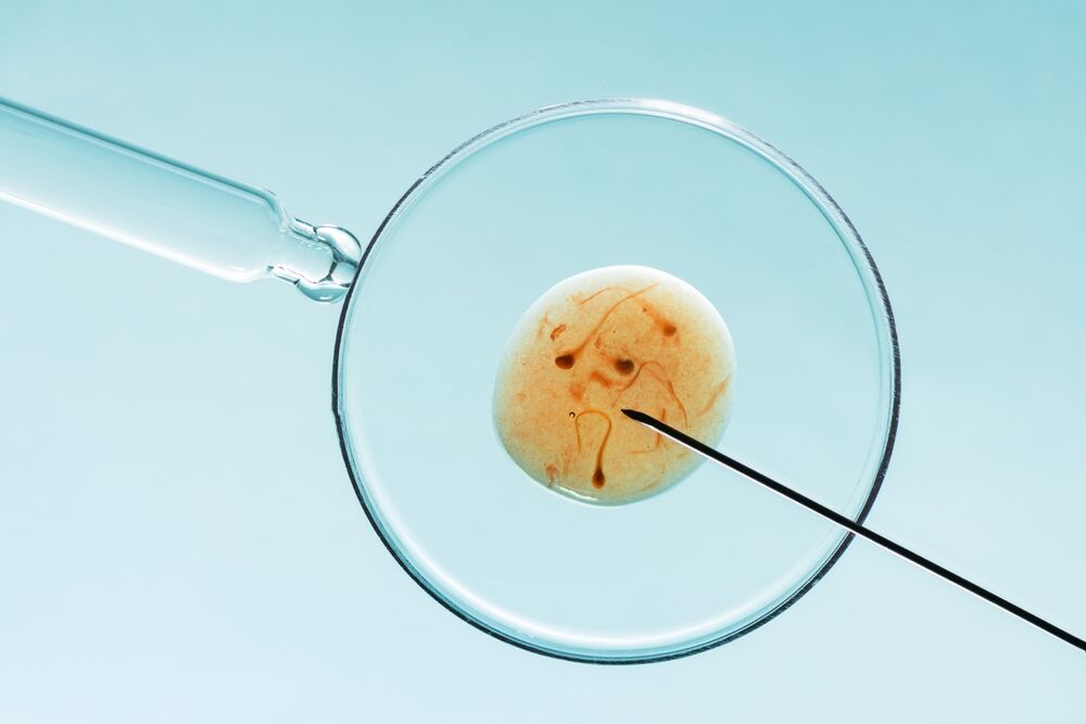 In vitro fertilization (IVF)